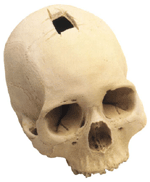 Trephined Cranium with Stand