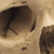 Trephined Cranium