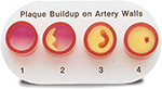 Model of Artery Walls Replica